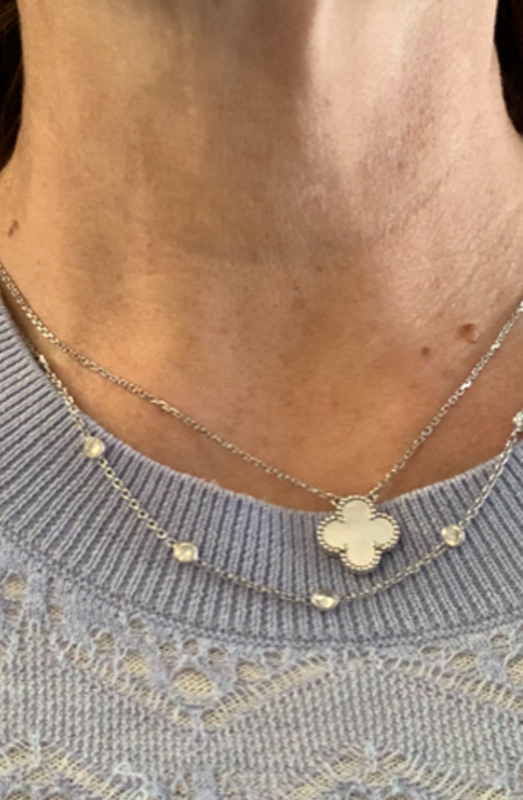 Neck & décolletage, after
