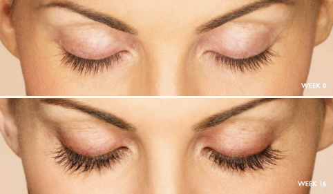 Latisse lash growth results