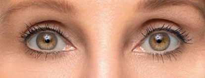Skin care treatment, after