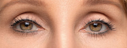 Skin care treatment, before