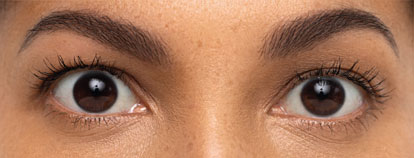 Skin care treatment, after