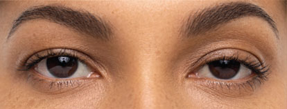 Skin care treatment, before