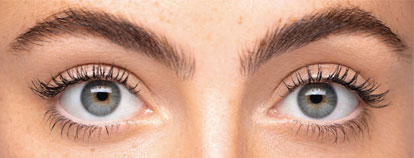 Skin care treatment, after