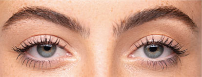 Skin care treatment, before